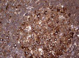 PIK3C2A Antibody in Immunohistochemistry (Paraffin) (IHC (P))