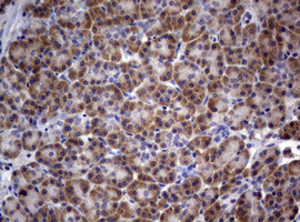 PIK3C2A Antibody in Immunohistochemistry (Paraffin) (IHC (P))