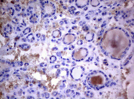 PIK3C2A Antibody in Immunohistochemistry (Paraffin) (IHC (P))