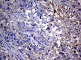 PIK3C2A Antibody in Immunohistochemistry (Paraffin) (IHC (P))