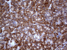 PIK3C2A Antibody in Immunohistochemistry (Paraffin) (IHC (P))