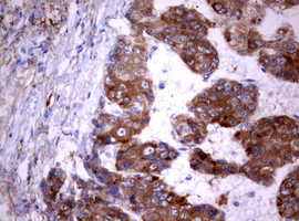 PIK3C2A Antibody in Immunohistochemistry (Paraffin) (IHC (P))