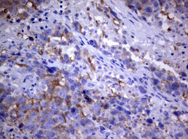 PIK3C2A Antibody in Immunohistochemistry (Paraffin) (IHC (P))