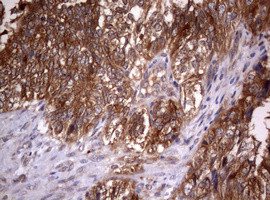 PIK3C2A Antibody in Immunohistochemistry (Paraffin) (IHC (P))