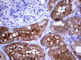 PIK3C2A Antibody in Immunohistochemistry (Paraffin) (IHC (P))