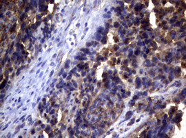 PIK3C2A Antibody in Immunohistochemistry (Paraffin) (IHC (P))