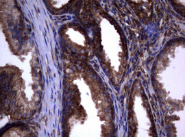 PIK3C2A Antibody in Immunohistochemistry (Paraffin) (IHC (P))