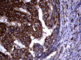 PIK3C2A Antibody in Immunohistochemistry (Paraffin) (IHC (P))