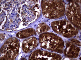 PIK3C2A Antibody in Immunohistochemistry (Paraffin) (IHC (P))