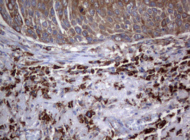 PIK3C2A Antibody in Immunohistochemistry (Paraffin) (IHC (P))