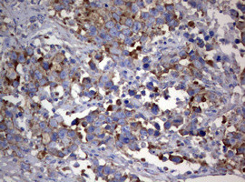 PIK3C2A Antibody in Immunohistochemistry (Paraffin) (IHC (P))