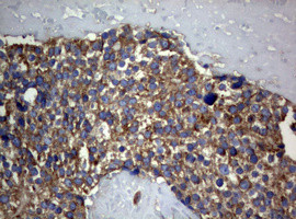 PIK3C2A Antibody in Immunohistochemistry (Paraffin) (IHC (P))