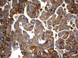 PIK3C2A Antibody in Immunohistochemistry (Paraffin) (IHC (P))