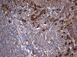 PIK3C2A Antibody in Immunohistochemistry (Paraffin) (IHC (P))