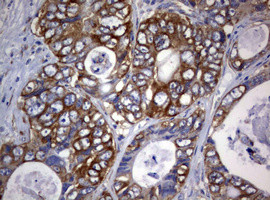 PIK3C2A Antibody in Immunohistochemistry (Paraffin) (IHC (P))