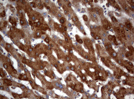 PIK3C2A Antibody in Immunohistochemistry (Paraffin) (IHC (P))