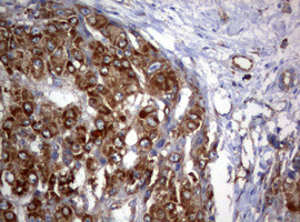 PIK3C2A Antibody in Immunohistochemistry (Paraffin) (IHC (P))