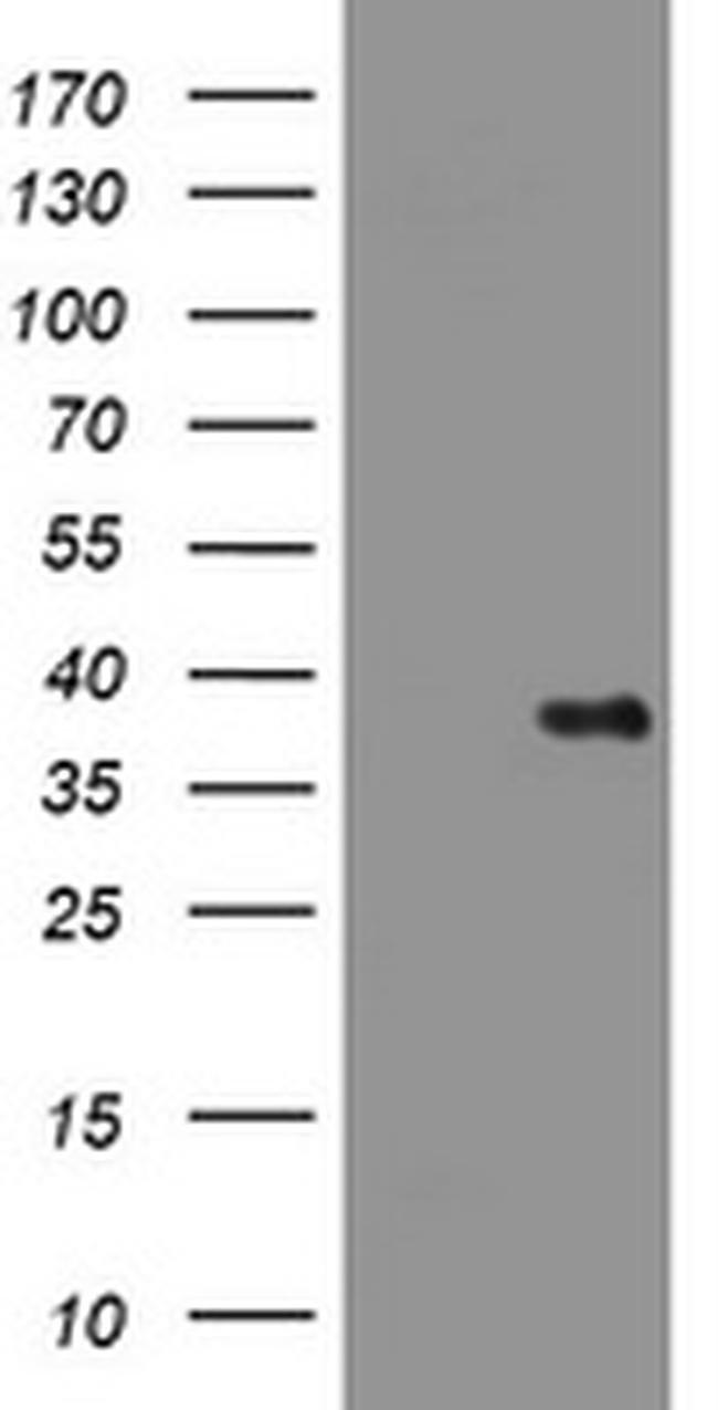 PIK3C2A Antibody in Western Blot (WB)