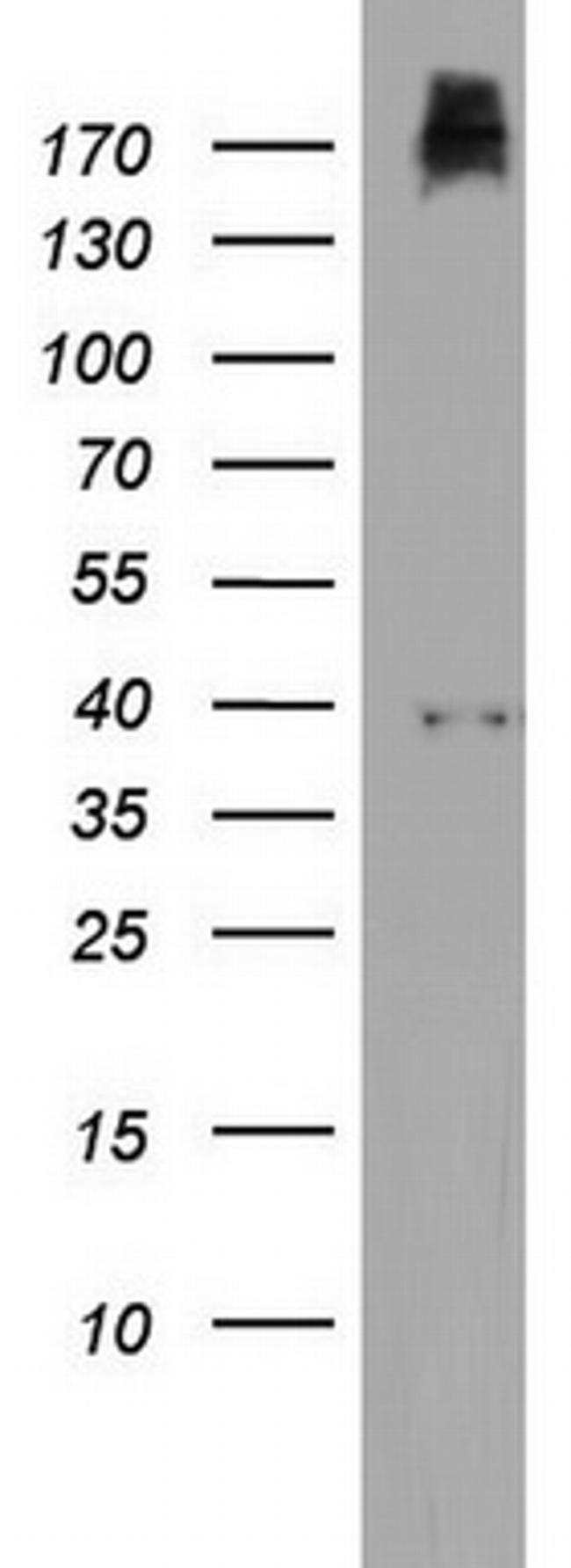 PIK3C2A Antibody in Western Blot (WB)