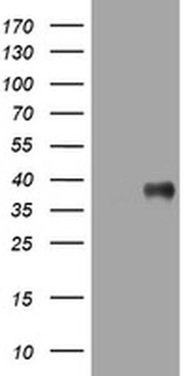 PIK3C2A Antibody in Western Blot (WB)