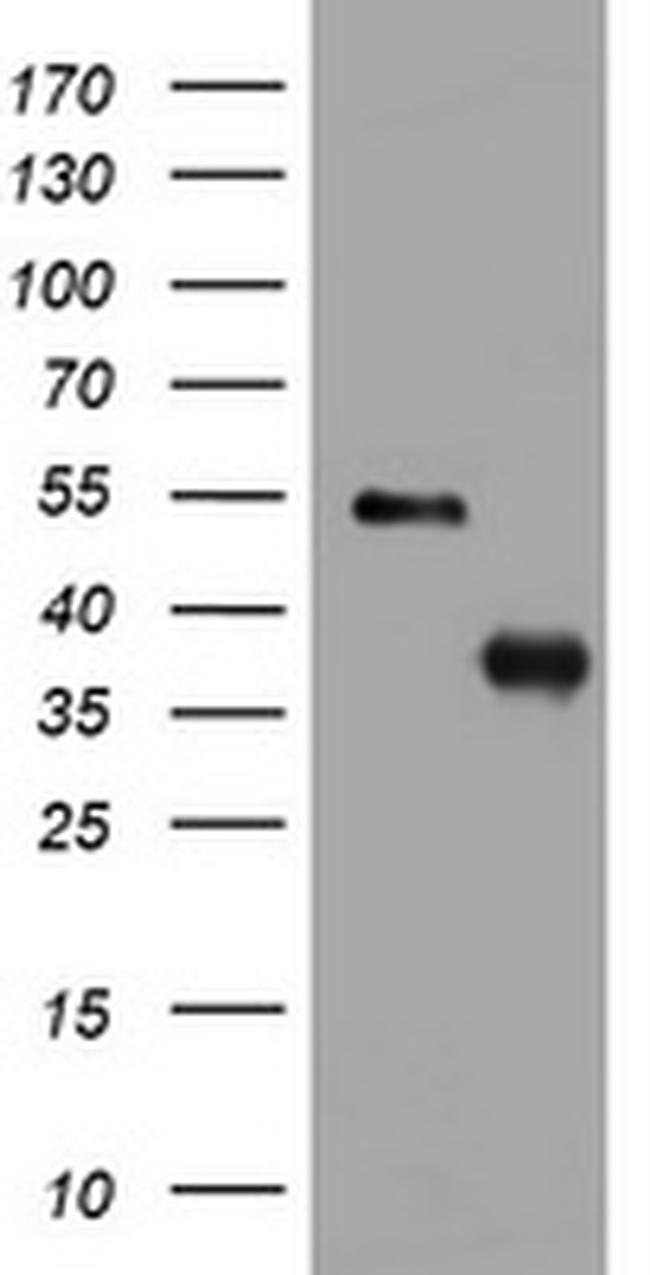 PIK3C2A Antibody in Western Blot (WB)