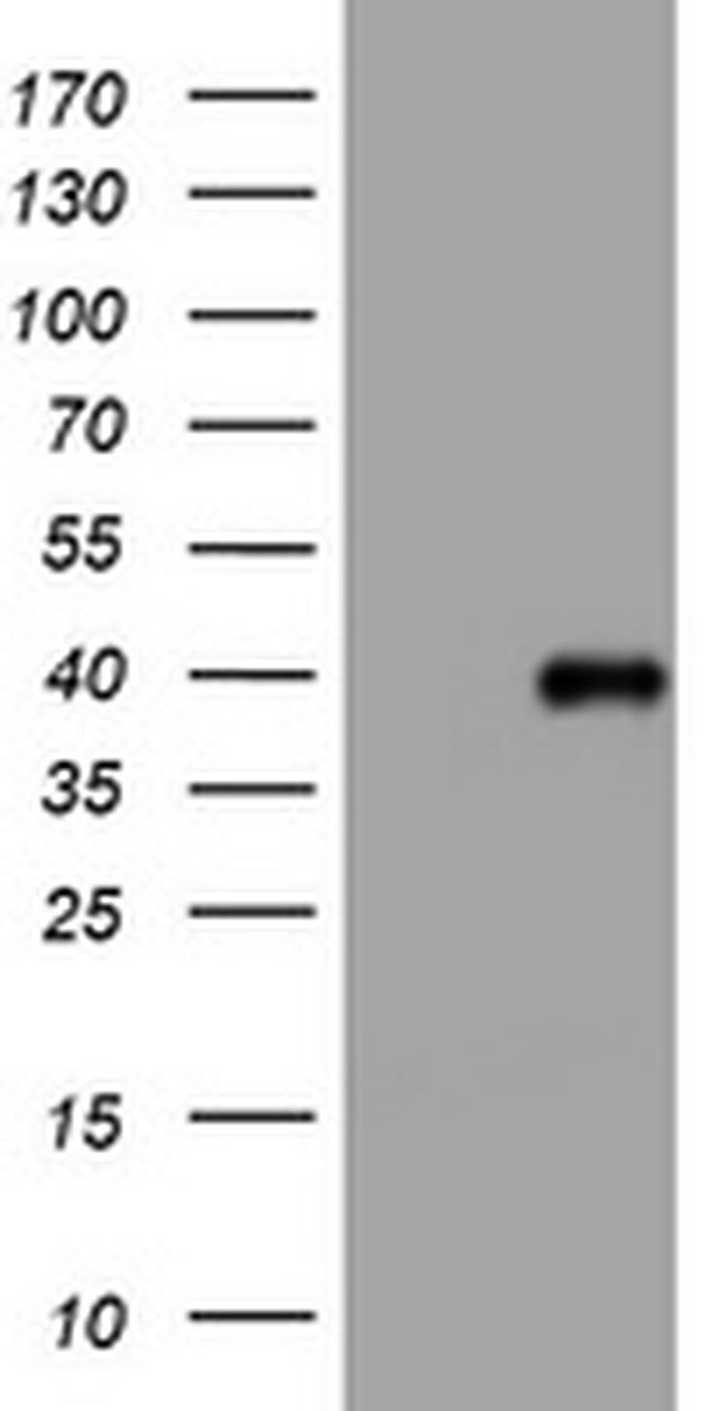 PIK3C2A Antibody in Western Blot (WB)