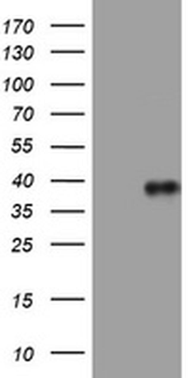 PIK3C2A Antibody in Western Blot (WB)