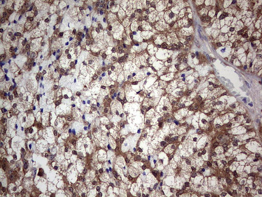 PIK3CA Antibody in Immunohistochemistry (Paraffin) (IHC (P))