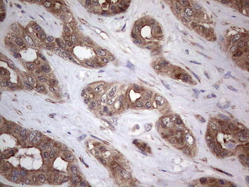 PIK3CA Antibody in Immunohistochemistry (Paraffin) (IHC (P))