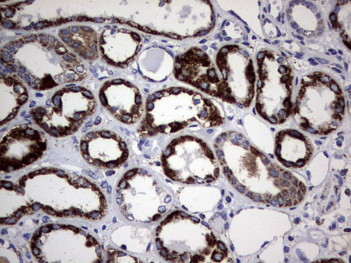 PIK3CD Antibody in Immunohistochemistry (Paraffin) (IHC (P))