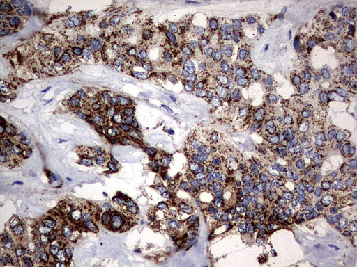 PIK3CD Antibody in Immunohistochemistry (Paraffin) (IHC (P))