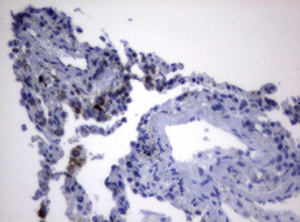 PIK3CD Antibody in Immunohistochemistry (Paraffin) (IHC (P))