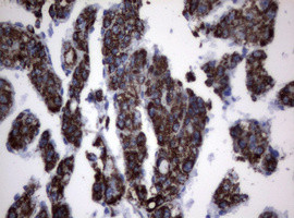 PIK3CD Antibody in Immunohistochemistry (Paraffin) (IHC (P))