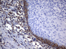 PIK3CD Antibody in Immunohistochemistry (Paraffin) (IHC (P))