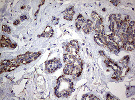 PIK3CD Antibody in Immunohistochemistry (Paraffin) (IHC (P))