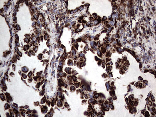 PIK3CD Antibody in Immunohistochemistry (Paraffin) (IHC (P))