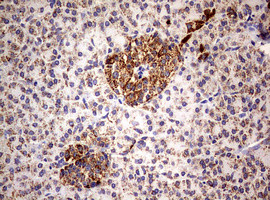 PIK3CD Antibody in Immunohistochemistry (Paraffin) (IHC (P))