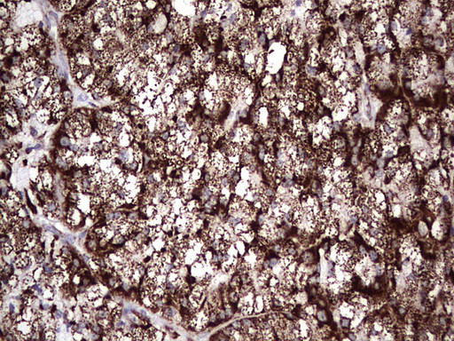 PIK3CD Antibody in Immunohistochemistry (Paraffin) (IHC (P))