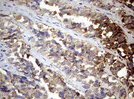 PIK3CD Antibody in Immunohistochemistry (Paraffin) (IHC (P))