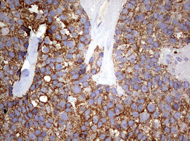 PIK3CD Antibody in Immunohistochemistry (Paraffin) (IHC (P))