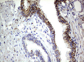 PIK3CD Antibody in Immunohistochemistry (Paraffin) (IHC (P))