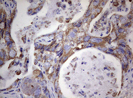 PIK3CD Antibody in Immunohistochemistry (Paraffin) (IHC (P))