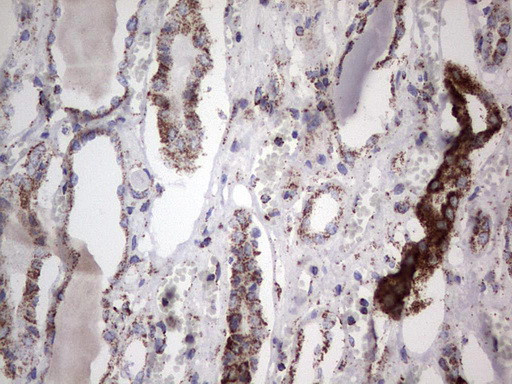 PIK3CD Antibody in Immunohistochemistry (Paraffin) (IHC (P))