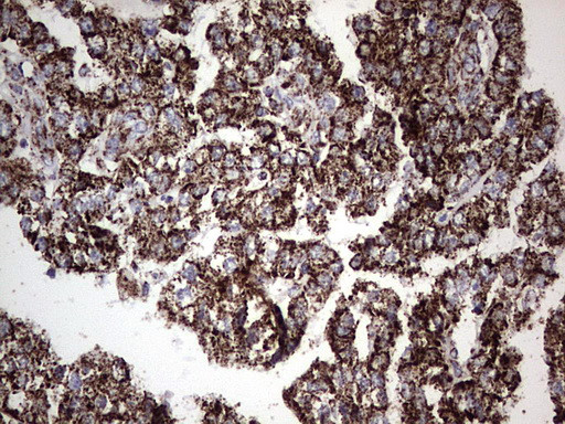 PIK3CD Antibody in Immunohistochemistry (Paraffin) (IHC (P))