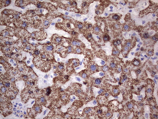 PIK3CD Antibody in Immunohistochemistry (Paraffin) (IHC (P))