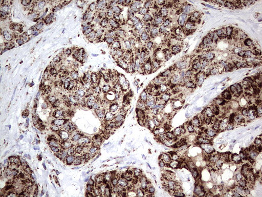 PIK3CD Antibody in Immunohistochemistry (Paraffin) (IHC (P))