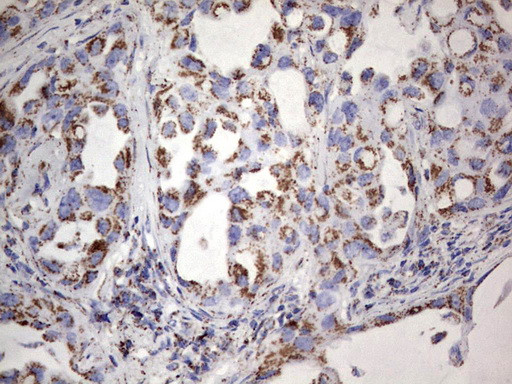 PIK3CD Antibody in Immunohistochemistry (Paraffin) (IHC (P))