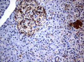 PIK3CD Antibody in Immunohistochemistry (Paraffin) (IHC (P))