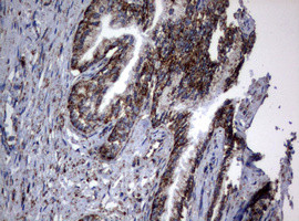 PIK3CD Antibody in Immunohistochemistry (Paraffin) (IHC (P))