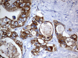 PIK3CD Antibody in Immunohistochemistry (Paraffin) (IHC (P))